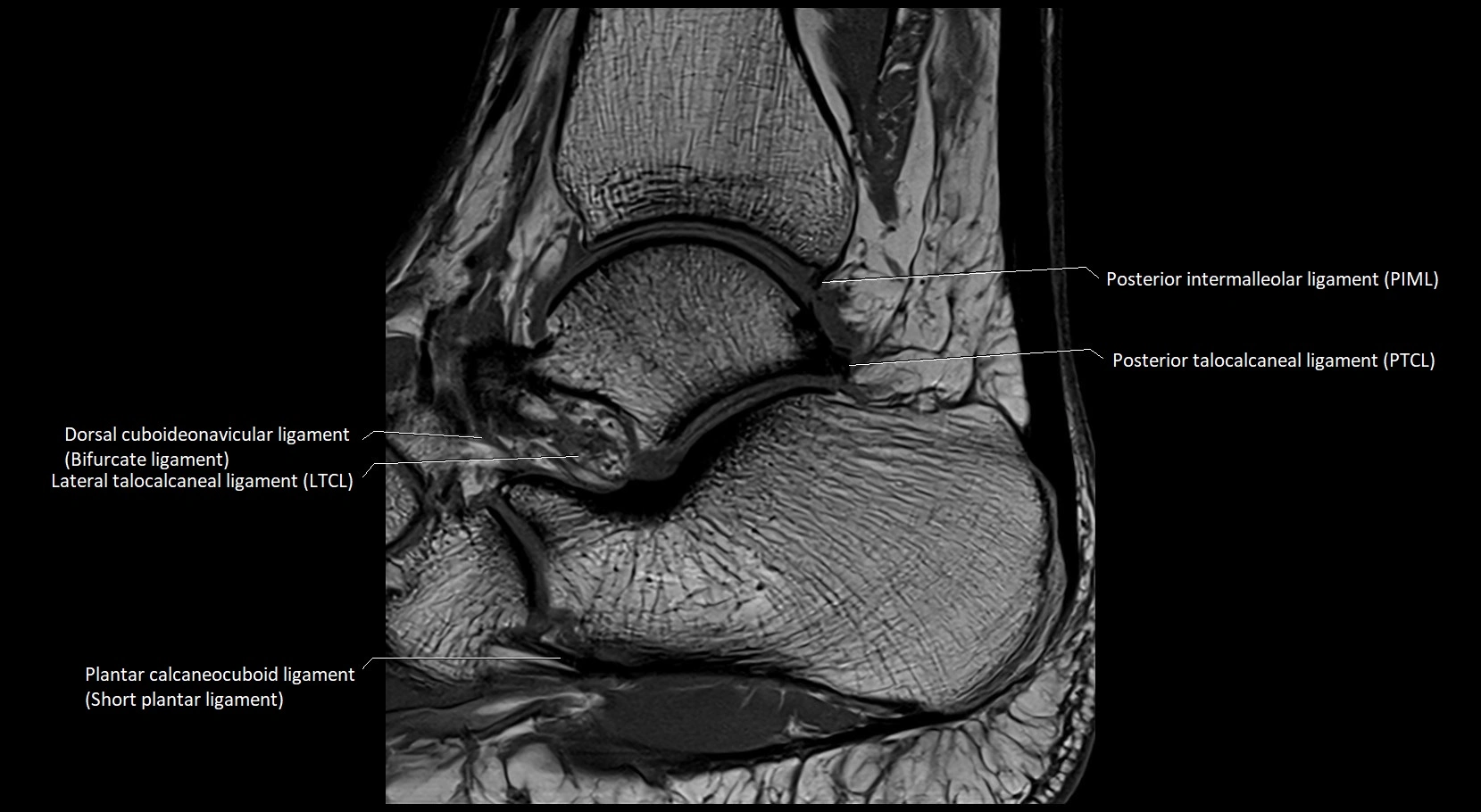 MRI ankle ligaments anatomy sagittal 3T image 16.webp